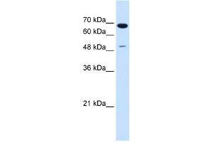 WB Suggested Anti-SILV Antibody Titration:  1.
