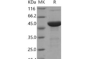 Western Blotting (WB) image for S100 Calcium Binding Protein A7A (S100A7A) protein (His tag,MBP tag) (ABIN7320360)