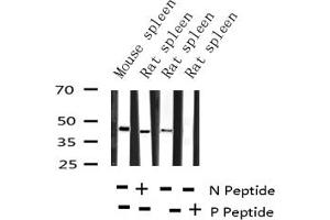 Western blot analysis of Phospho-CCR5 (Ser336) expression in various lysates