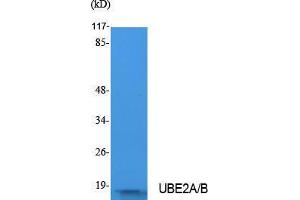 Western Blotting (WB) image for anti-UBE2A/B (C-Term) antibody (ABIN3180974) (UBE2A/B (C-Term) anticorps)