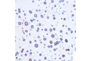 Immunohistochemistry of paraffin-embedded Mouse liver using CHD4 antibody (ABIN6127308, ABIN6138512, ABIN6138513 and ABIN6215263) at dilution of 1:100 (40x lens).