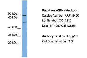 WB Suggested Anti-CRNN Antibody   Titration: 1. (CRNN anticorps  (Middle Region))