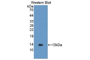 Western blot analysis of the recombinant protein. (CXCL1 anticorps  (AA 25-96))