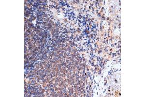Immunohistochemistry of paraffin-embedded rat spleen using FNTB Rabbit mAb (ABIN1680761, ABIN3016316, ABIN3016317 and ABIN7101479) at dilution of 1:100 (40x lens).