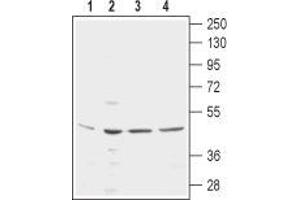 Western blot analysis using Mouse Anti-KCNN4 (KCa3. (KCNN4 anticorps  (3rd Extracellular Loop, Extracellular Loop))