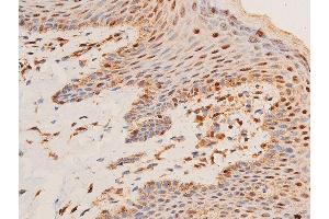 ABIN6267221 at 1/100 staining human skin tissue sections by IHC-P.