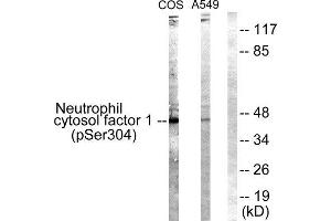 Western Blotting (WB) image for anti-Neutrophil Cytosol Factor 1 (NCF1) (pSer304) antibody (ABIN1847419) (NCF1 anticorps  (pSer304))