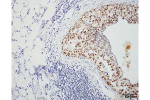 Immunohistochemistry analysis using Rat Anti-HSF1 Monoclonal Antibody, Clone 4B4 .