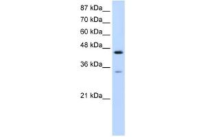 WB Suggested Anti-SF3B4 Antibody Titration:  0. (SF3B4 anticorps  (N-Term))