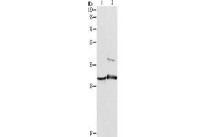 Gel: 10 % SDS-PAGE, Lysate: 40 μg, Lane 1-2: Mouse muscle tissue, Mouse skin tissue, Primary antibody: ABIN7189850(APOBEC2 Antibody) at dilution 1/450, Secondary antibody: Goat anti rabbit IgG at 1/8000 dilution, Exposure time: 10 seconds (APOBEC2 anticorps)