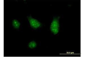 Immunofluorescence of purified MaxPab antibody to CISH on HeLa cell.