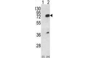 Western Blotting (WB) image for anti-Heterogeneous Nuclear Ribonucleoprotein L (HNRNPL) antibody (ABIN3001739) (HNRNPL anticorps)