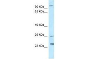 Image no. 1 for anti-Chromosome 17 Open Reading Frame 70 (C17ORF70) (AA 92-141) antibody (ABIN6747793) (C17orf70 anticorps  (AA 92-141))