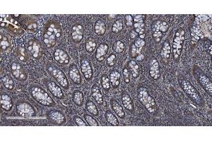 IHC analysis of MIEF1 using anti-MIEF1 antibody (ABIN7600396). (SMCR7L anticorps  (AA 189-463))