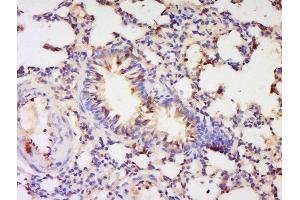 Formalin-fixed and paraffin embedded rat lung labeled with Anti-PBEF1 Polyclonal Antibody, Unconjugated  at 1:200 followed by conjugation to the secondary antibody and DAB staining. (NAMPT anticorps  (AA 301-400))