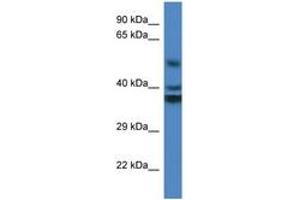 Image no. 1 for anti-Reticulon 4 Interacting Protein 1 (RTN4IP1) (AA 188-237) antibody (ABIN6746876) (RTN4IP1 anticorps  (AA 188-237))