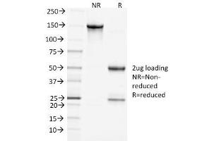 SDS-PAGE Analysis Purified Clathrin, HC Monoclonal Antibody (CHC/1432).