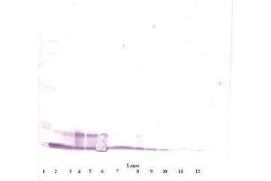 Image no. 4 for anti-Chemokine (C-X-C Motif) Ligand 10 (CXCL10) antibody (ABIN465012) (CXCL10 anticorps)