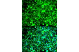 Immunofluorescence analysis of U20S cell using ADIPOR1 antibody. (Adiponectin Receptor 1 anticorps)
