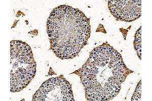 ABIN7096169 and ABIN7100231 at 1/100 staining mouse testis tissue by IHC-P. (RASAL1 anticorps)