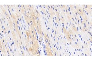 Detection of TNNT2 in Porcine Cardiac Muscle Tissue using Polyclonal Antibody to Troponin T Type 2, Cardiac (TNNT2) (Cardiac Troponin T2 anticorps  (AA 56-271))