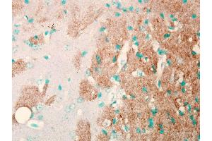 Immunohistochemistry analysis using Mouse Anti-Nav1.