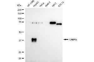Western blotting analysis using C4BPB antibody (ABIN7798141). (Recombinant C4BPB anticorps)