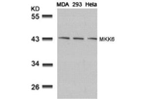 Image no. 3 for anti-Mitogen-Activated Protein Kinase Kinase 6 (MAP2K6) (AA 205-209) antibody (ABIN197354) (MAP2K6 anticorps  (AA 205-209))
