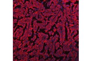 IF analysis of EML4 using anti-EML4 antibody (ABIN6719384). (EML4 anticorps  (AA 207-423))