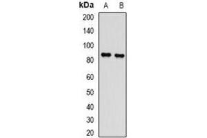 Western blot analysis of L3MBTL3 expression in Hela (A), mouse spleen (B) whole cell lysates. (L3MBTL3 anticorps)