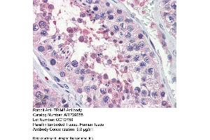 Immunohistochemistry with Human Testis lysate tissue at an antibody concentration of 5. (TRIM8 anticorps  (N-Term))