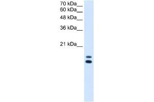 UXT antibody used at 2. (UXT anticorps  (N-Term))