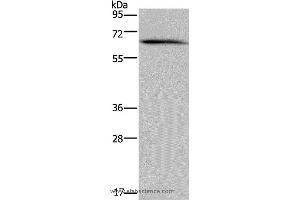 Western blot analysis of Human brain malignant glioma tissue, using NCF2 Polyclonal Antibody at dilution of 1:200 (NCF2 anticorps)