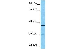 Host:  Rabbit  Target Name:  TTP  Sample Type:  Fetal Lung lysates  Antibody Dilution:  0.