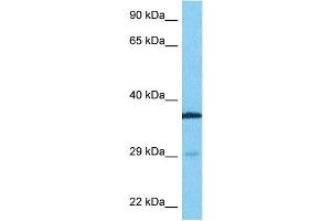 Host:  Rabbit  Target Name:  TTP  Sample Type:  Fetal Lung lysates  Antibody Dilution:  0. (ZFP36 anticorps  (N-Term))