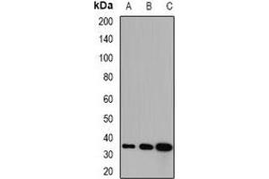 Western blot analysis of GPD1 expression in mouse kidney (A), mouse skeletal muscle (B), rat liver (C) whole cell lysates. (GPD1 anticorps)
