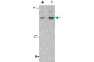 Western blot analysis of BANF1 in human kidney tissue lysate with BANF1 polyclonal antibody  at (A) 0. (BANF1 anticorps  (C-Term))
