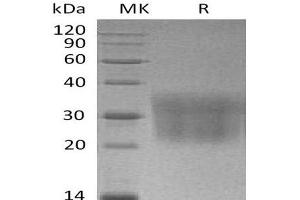 Western Blotting (WB) image for Chemokine (C-C Motif) Ligand 2 (CCL2) protein (His tag) (ABIN7320482)