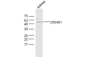 Mouse kidney lysates probed with CRHR1 Polyclonal Antibody, Unconjugated  at 1:300 dilution and 4˚C overnight incubation. (CRHR1 anticorps  (AA 55-150))