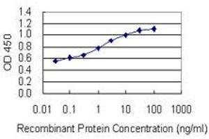 anti-Glucose-6-Phosphate Isomerase (GPI) (AA 1-558) antibody