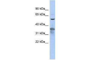 RAB3IP antibody used at 1 ug/ml to detect target protein. (RAB3IP anticorps)