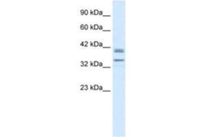 Western Blotting (WB) image for anti-One Cut Homeobox 3 (ONECUT3) antibody (ABIN2460969) (ONECUT3 anticorps)