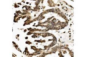 IHC analysis of TXNIP using anti-TXNIP antibody (ABIN7601882).