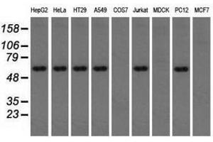 Image no. 8 for anti-thromboxane A Synthase 1 (Platelet) (TBXAS1) antibody (ABIN1501382)