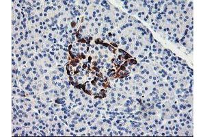 Immunohistochemical staining of paraffin-embedded Human pancreas tissue using anti-ACSS2 mouse monoclonal antibody. (ACSS2 anticorps)