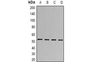 Western blot analysis of SEN2 expression in Hela (A), A549 (B), mouse brain (C), rat heart (D) whole cell lysates. (TSEN2 anticorps)