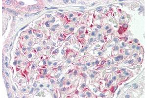 Image no. 3 for anti-STE20-Like Kinase (SLK) (AA 1151-1200) antibody (ABIN2879164) (SLK anticorps  (AA 1151-1200))