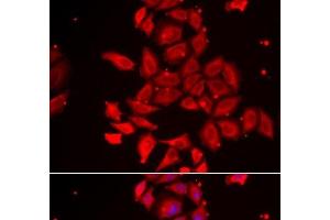Immunofluorescence analysis of U2OS cells using TMOD4 Polyclonal Antibody (Tropomodulin 4 anticorps)