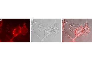 Expression of NKCC1 in human U-87 MG cells - Cell surface detection of NKCC1 in live intact human U-87 MG glioblastoma cells.
