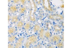 Immunohistochemistry of paraffin-embedded Mouse kidney using CYP4A11 Polyclonal Antibody at dilution of 1:100 (40x lens). (CYP4A11 anticorps)